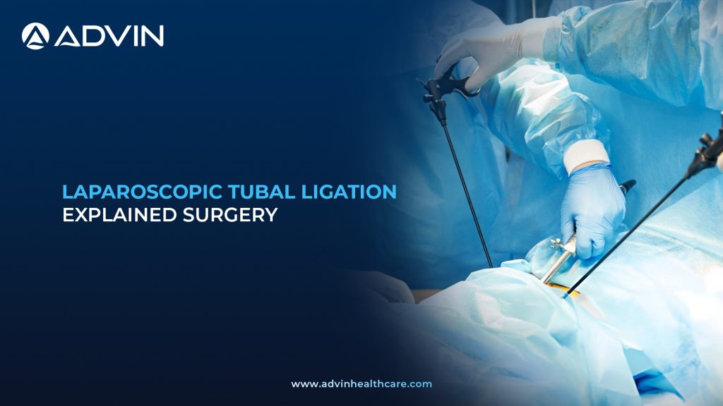 Laparoscopic Tubal Ligation Explained Surgery – Stepwise Minimally Invasive Approach to Tubal Occlusion.