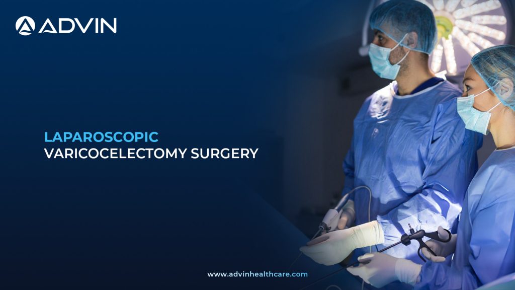 Laparoscopic Varicocelectomy Surgery – Modern Urologic Solution for Varicocele Management