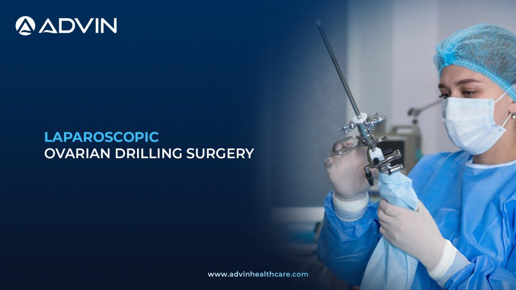 Laparoscopic Ovarian Drilling Surgery – Effective Minimally Invasive Approach for Resistant Polycystic Ovaries