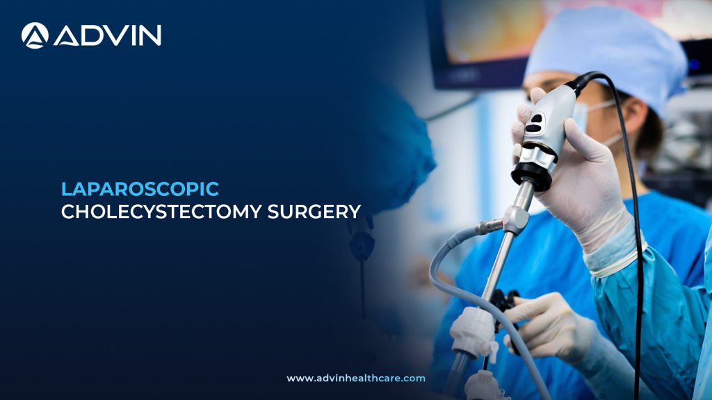 Laparoscopic Cholecystectomy Surgery – Modern Surgical Solution for Symptomatic Cholelithiasis