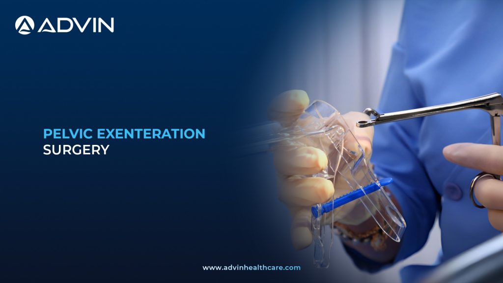 Pelvic Exenteration Surgery Advanced Surgical Treatment for Pelvic Cancers