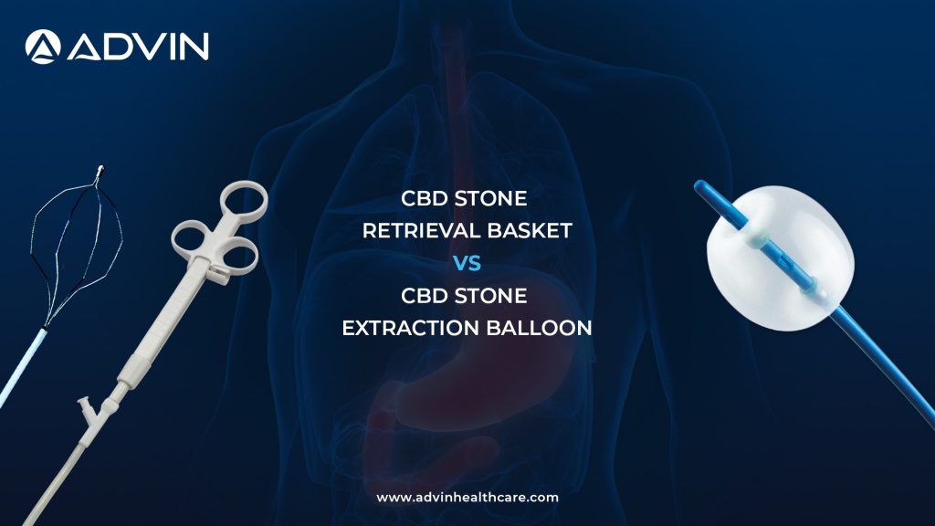 CBD Stone Retrieval Basket vs CBD Extraction Balloon – Grasping vs Sweeping in ERCP Stone Removal