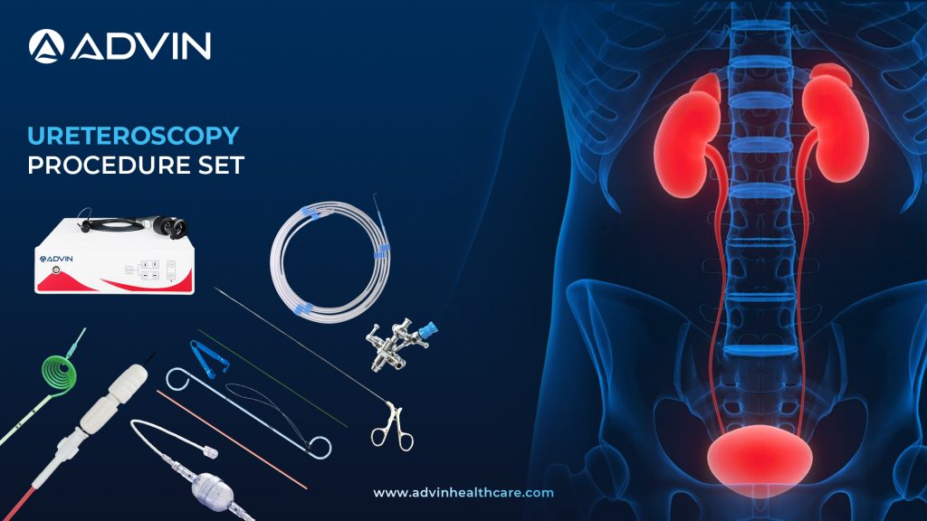 Ureteroscopy Procedure Set – Complete Solution for Advanced Ureteral Stone Management