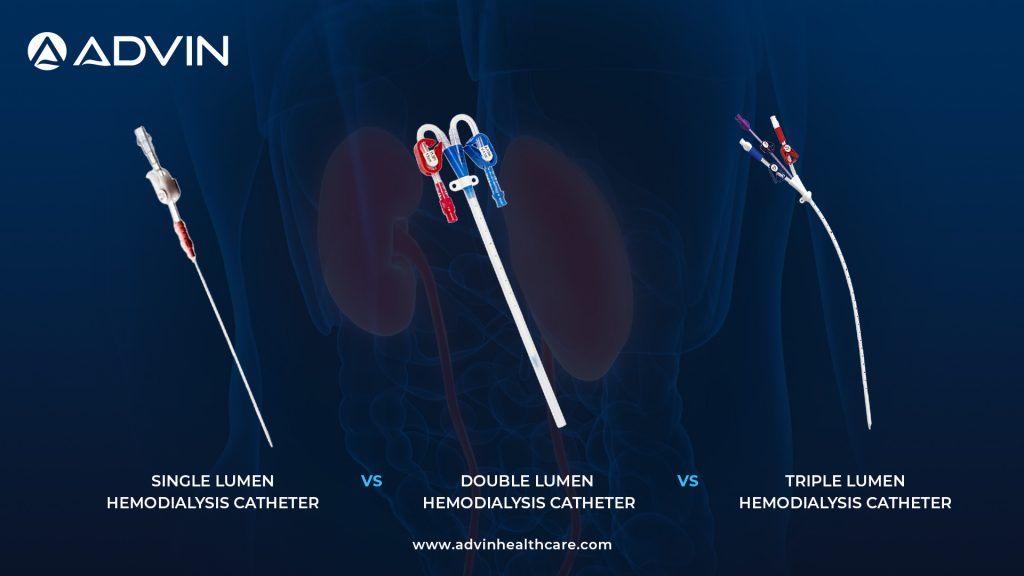 Single Lumen vs Double Lumen vs Triple Lumen Hemodialysis Catheters – Key Differences Explained