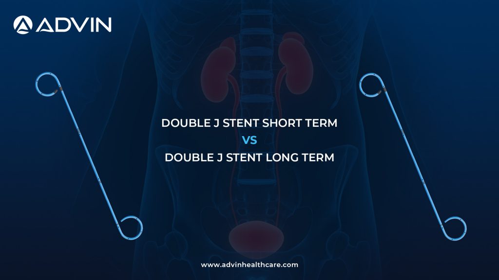 Double J Stent Short Term vs Double J Stent Long Term: Choosing the Right Duration for Ureteral Drainage