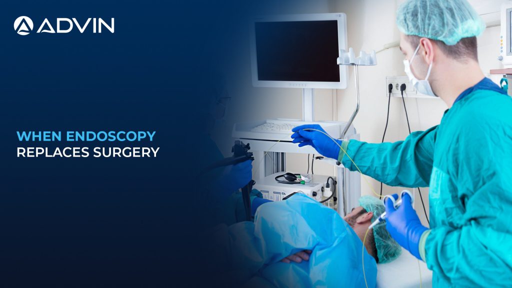 When Endoscopy Replaces Surgery – The Rise of Minimally Invasive GI Treatment