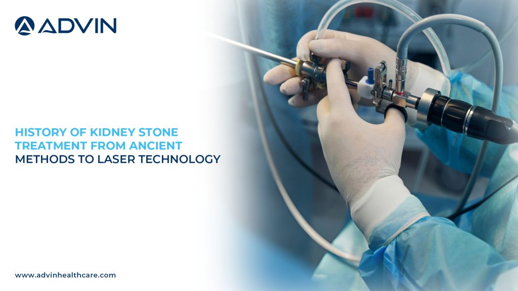 History of Kidney Stone Treatment – From Ancient Methods to Laser Technology