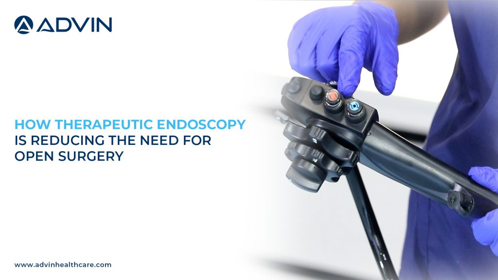 How Therapeutic Endoscopy Is Reducing the Need for Open Surgery